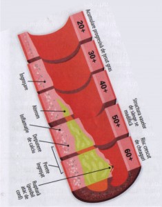 varsta arteriala